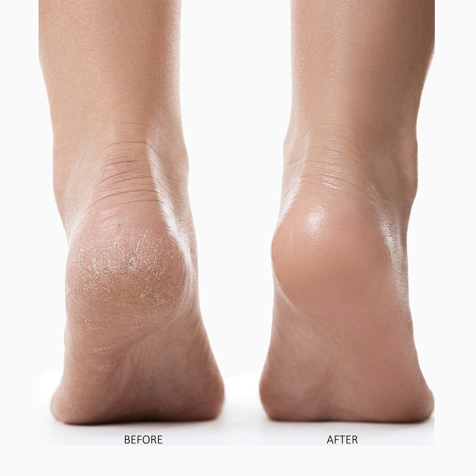 Kirile Silk 7 Pro Electric Foot Smoother