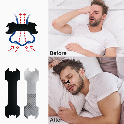 Anti Snoring Nose Patch Set For Better Breathing